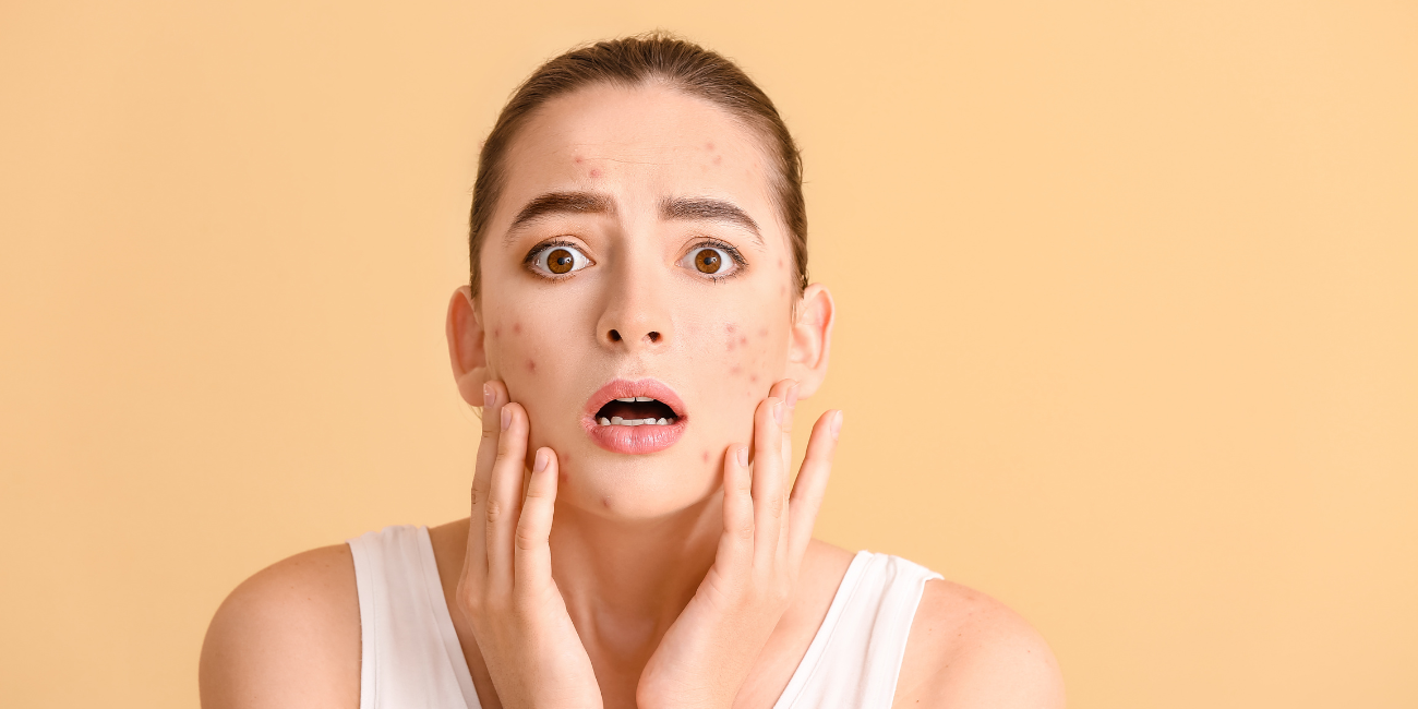 avocado-oil-for-hormonal-acne-a-fatty-acid-approach-to-skin-clarity-